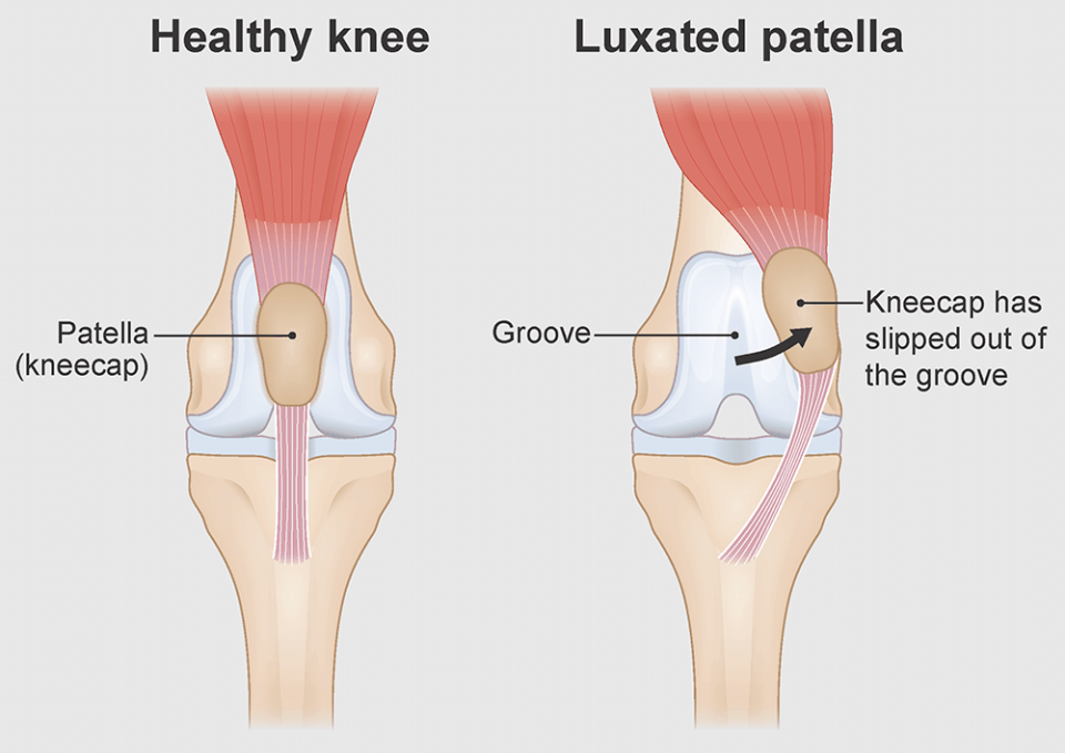 Luxating Patellar Correction